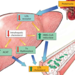 hyperlipidemia