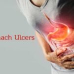 stomach-ulcers